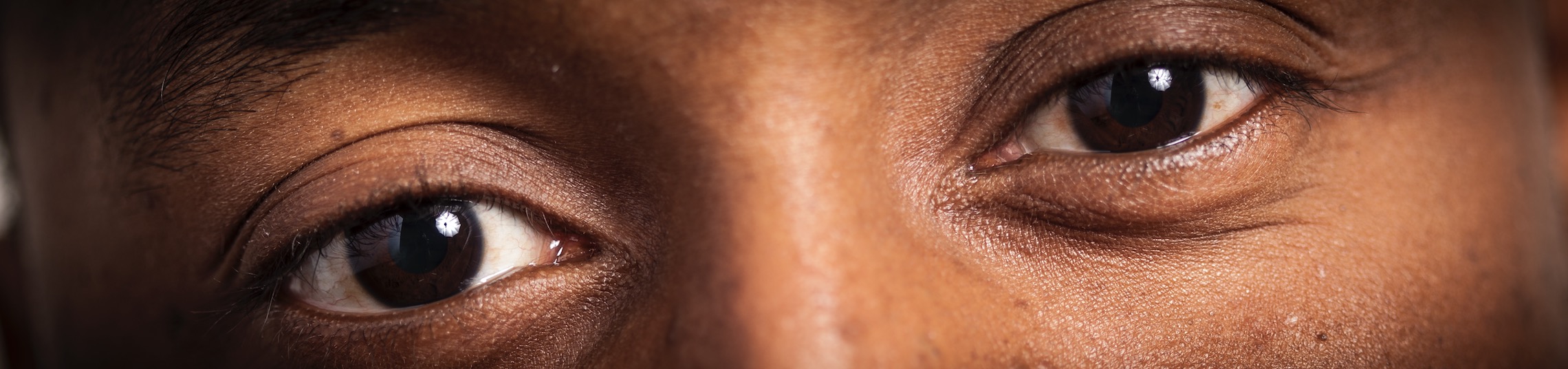 Premier Eye Care Premier Expertise. Premier Service.
