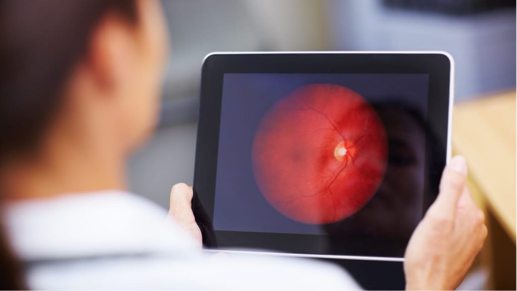 TeleVision Archives Premier Eye Care